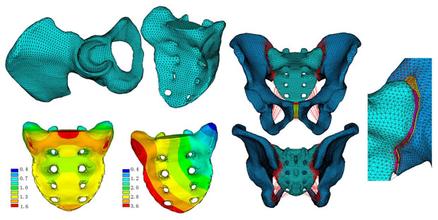 ����Ԫ����